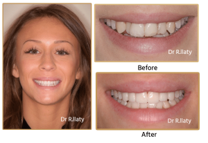 claudia cosmetic dentistry london