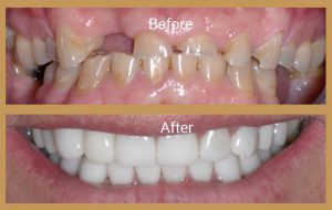 cosmetic dentist london