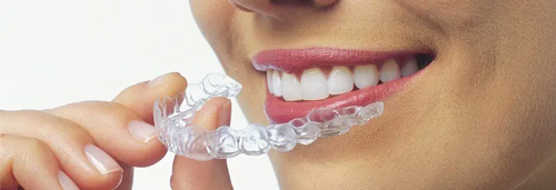 Clear Aligner