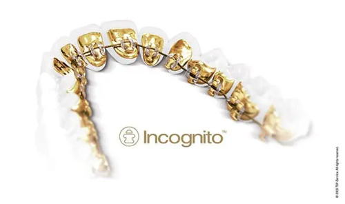 Incognito Braces