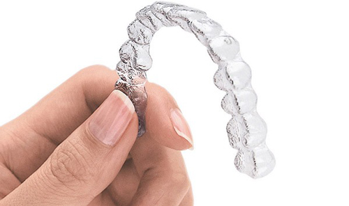 Invisalign Brace