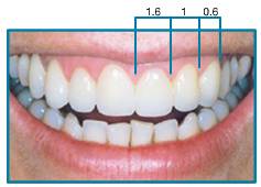 Correct Tooth Proportions