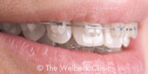 Orthodontics