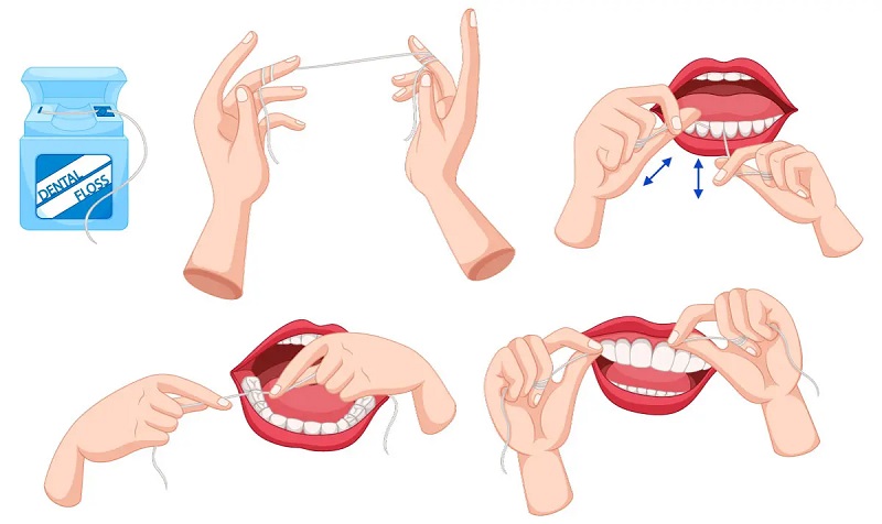 How to Floss Correctly